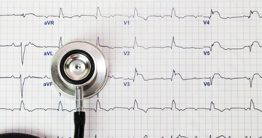 Atrial Fibrillation Treatment: Exploring Options