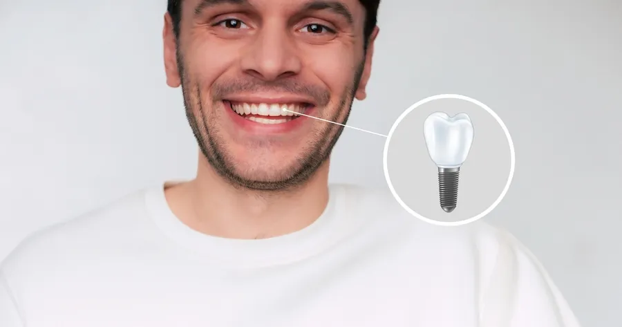Are You Eligible for Dental Implant Trials?