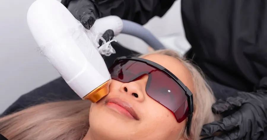 What Affects Laser Facelift Pricing?
