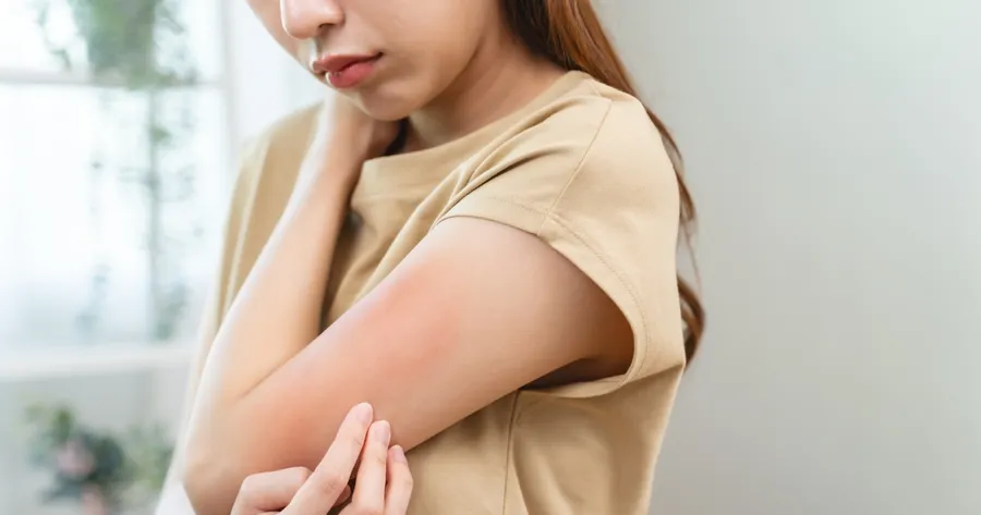 Rinvoq: A Game-Changer for Atopic Dermatitis Care